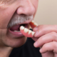 What Are Dentures and Why Do You Need Them?