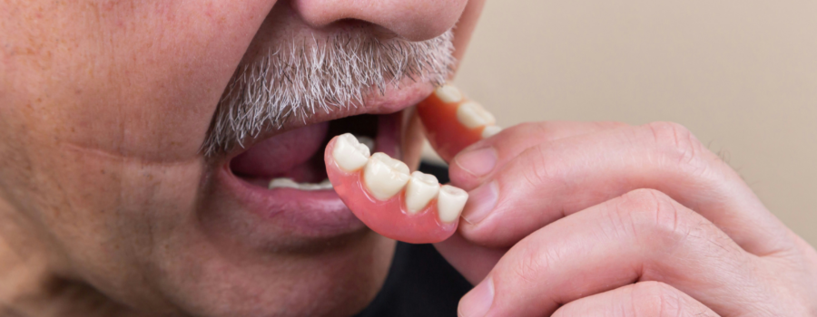 What Are Dentures and Why Do You Need Them?